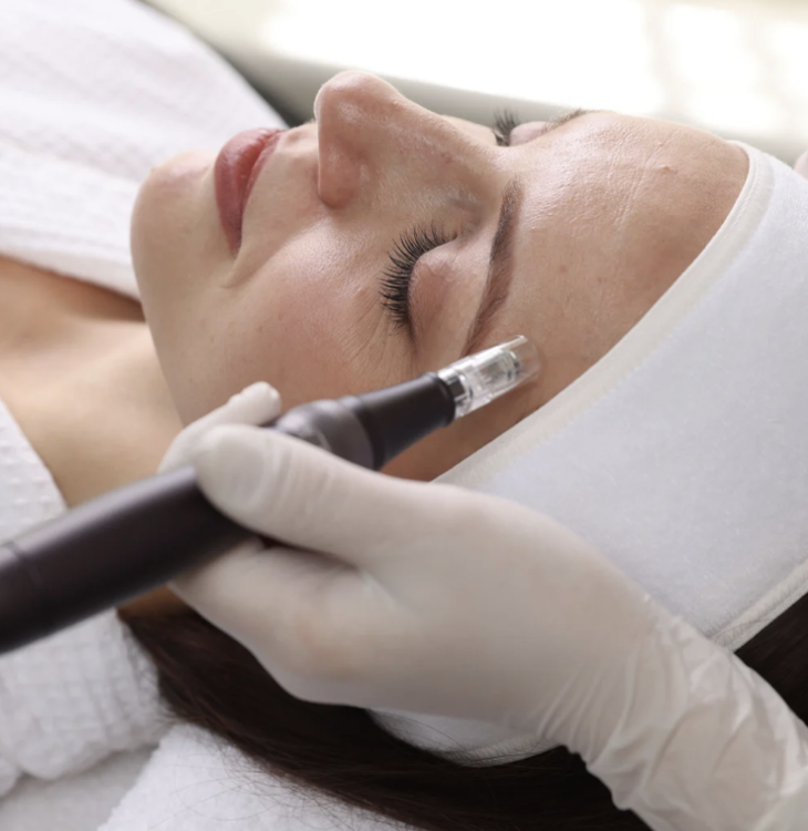 Featured image for Microneedling in Ellicott City, MD: Your Guide to Smoother, Healthier-Looking Skin - Define Hair & Skin